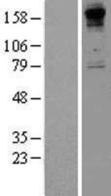 Western Blot: Collagen VIII alpha 1 Overexpression Lysate (Adult Normal) [NBP2-10778] Left-Empty vector transfected control cell lysate (HEK293 cell lysate); Right -Over-expression Lysate for Collagen VIII alpha 1.