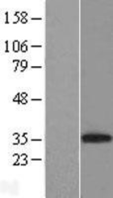 Western Blot: CD8 alpha Overexpression Lysate (Adult Normal) [NBP2-10773] Left-Empty vector transfected control cell lysate (HEK293 cell lysate); Right -Over-expression Lysate for CD8 alpha.