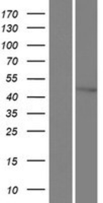 Western Blot: XPD Overexpression Lysate (Adult Normal) [NBP2-11103] Left-Empty vector transfected control cell lysate (HEK293 cell lysate); Right -Over-expression Lysate for XPD.
