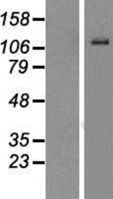 Western Blot: Enterokinase Overexpression Lysate (Adult Normal) [NBP2-10849] Left-Empty vector transfected control cell lysate (HEK293 cell lysate); Right -Over-expression Lysate for Enterokinase.