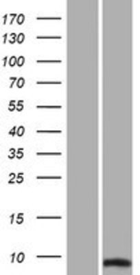 Western Blot: Sumo 2 Overexpression Lysate (Adult Normal) [NBP2-10752] Left-Empty vector transfected control cell lysate (HEK293 cell lysate); Right -Over-expression Lysate for Sumo 2.