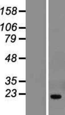 Western Blot: THYN1 Overexpression Lysate (Adult Normal) [NBL1-16905] Left-Empty vector transfected control cell lysate (HEK293 cell lysate); Right -Over-expression Lysate for THYN1.