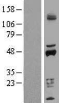 Western Blot: Cytochrome P450 2D6 Overexpression Lysate (Adult Normal) [NBP2-11031] Left-Empty vector transfected control cell lysate (HEK293 cell lysate); Right -Over-expression Lysate for Cytochrome P450 2D6.