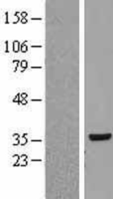 Western Blot: RPLP0 Overexpression Lysate (Adult Normal) [NBP2-09085] Left-Empty vector transfected control cell lysate (HEK293 cell lysate); Right -Over-expression Lysate for RPLP0.