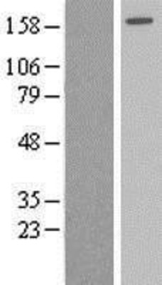 Western Blot: AGL Overexpression Lysate (Adult Normal) [NBP2-09076] Left-Empty vector transfected control cell lysate (HEK293 cell lysate); Right -Over-expression Lysate for AGL.