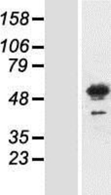 Western Blot: Meis homeobox 3 Overexpression Lysate (Adult Normal) [NBP2-11012] Left-Empty vector transfected control cell lysate (HEK293 cell lysate); Right -Over-expression Lysate for Meis homeobox 3.