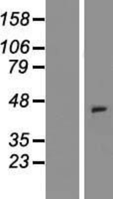 Western Blot: CCXCR1 Overexpression Lysate (Adult Normal) [NBP2-11040] Left-Empty vector transfected control cell lysate (HEK293 cell lysate); Right -Over-expression Lysate for CCXCR1.