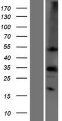 Western Blot: Carbonic Anhydrase IV Overexpression Lysate (Adult Normal) [NBP2-10691] Left-Empty vector transfected control cell lysate (HEK293 cell lysate); Right -Over-expression Lysate for Carbonic Anhydrase IV.