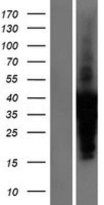 Western Blot: Troponin I Type 3 (cardiac) Overexpression Lysate (Adult Normal) [NBP2-11142] Left-Empty vector transfected control cell lysate (HEK293 cell lysate); Right -Over-expression Lysate for Troponin I Type 3 (cardiac).