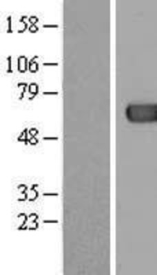 Western Blot: ACOT12 Overexpression Lysate (Adult Normal) [NBL1-07247] Left-Empty vector transfected control cell lysate (HEK293 cell lysate); Right -Over-expression Lysate for ACOT12.