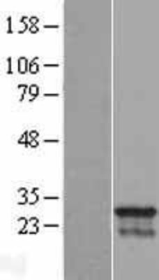 Western Blot: CDCA4 Overexpression Lysate (Adult Normal) [NBL1-09017] Left-Empty vector transfected control cell lysate (HEK293 cell lysate); Right -Over-expression Lysate for CDCA4.