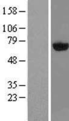 Western Blot: PAPSS2 Overexpression Lysate (Adult Normal) [NBL1-14096] Left-Empty vector transfected control cell lysate (HEK293 cell lysate); Right -Over-expression Lysate for PAPSS2.