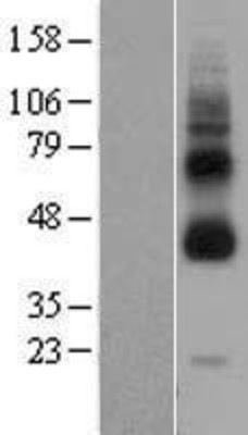 Western Blot: GPR119 Overexpression Lysate (Adult Normal) [NBL1-11245] Left-Empty vector transfected control cell lysate (HEK293 cell lysate); Right -Over-expression Lysate for GPR119.