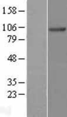 Western Blot: NDST3 Overexpression Lysate (Adult Normal) [NBL1-13533] Left-Empty vector transfected control cell lysate (HEK293 cell lysate); Right -Over-expression Lysate for NDST3.