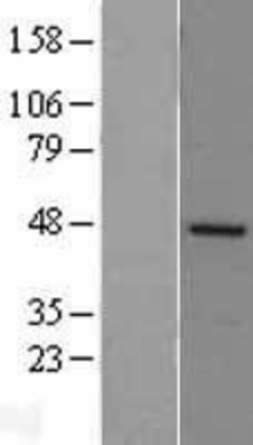 Western Blot: DP2 Overexpression Lysate (Adult Normal) [NBL1-16836] Left-Empty vector transfected control cell lysate (HEK293 cell lysate); Right -Over-expression Lysate for DP2.