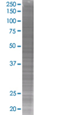 DIDO1 transfected lysate