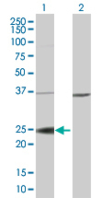 Lane 1: RAB38 transfected lysate (23.7 KDa). Lane 2: Non-transfected lysate.