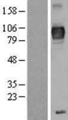 Western Blot: TYRP1 Overexpression Lysate (Adult Normal) [NBP2-04163] Left-Empty vector transfected control cell lysate (HEK293 cell lysate); Right -Over-expression Lysate for TYRP1.