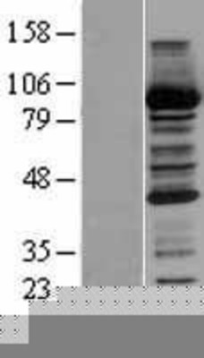 Western Blot: CBR1 Overexpression Lysate (Adult Normal) [NBP2-04206] Left-Empty vector transfected control cell lysate (HEK293 cell lysate); Right -Over-expression Lysate for CBR1.