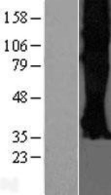 Western Blot: Somatostatin Receptor 3 Overexpression Lysate (Adult Normal) [NBP2-10911] Left-Empty vector transfected control cell lysate (HEK293 cell lysate); Right -Over-expression Lysate for Somatostatin Receptor 3.