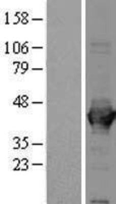 Western Blot: Aldolase A Overexpression Lysate (Adult Normal) [NBP2-11369] Left-Empty vector transfected control cell lysate (HEK293 cell lysate); Right -Over-expression Lysate for Aldolase A.