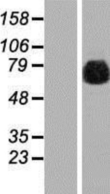 Western Blot: gamma Adducin Overexpression Lysate (Adult Normal) [NBP2-11402] Left-Empty vector transfected control cell lysate (HEK293 cell lysate); Right -Over-expression Lysate for gamma Adducin.