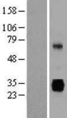 Western Blot: gamma Sarcoglycan Overexpression Lysate (Adult Normal) [NBP2-11158] Left-Empty vector transfected control cell lysate (HEK293 cell lysate); Right -Over-expression Lysate for gamma Sarcoglycan.