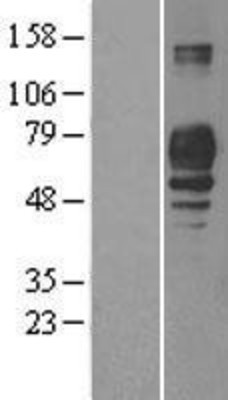 Western Blot: PLD3/Phospholipase D3 Overexpression Lysate (Adult Normal) [NBP2-11295] Left-Empty vector transfected control cell lysate (HEK293 cell lysate); Right -Over-expression Lysate for PLD3/Phospholipase D3.