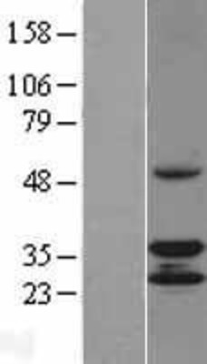 Western Blot: CCDC44 Overexpression Lysate (Adult Normal) [NBL1-08796] Left-Empty vector transfected control cell lysate (HEK293 cell lysate); Right -Over-expression Lysate for CCDC44.