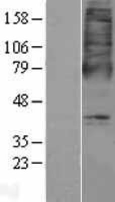 Western Blot: 5-oxo-ETE GPCR Overexpression Lysate (Adult Normal) [NBP2-04425] Left-Empty vector transfected control cell lysate (HEK293 cell lysate); Right -Over-expression Lysate for 5-oxo-ETE GPCR.