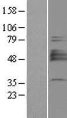 Western Blot: SIAT4A Overexpression Lysate (Adult Normal) [NBP2-04433] Left-Empty vector transfected control cell lysate (HEK293 cell lysate); Right -Over-expression Lysate for SIAT4A.