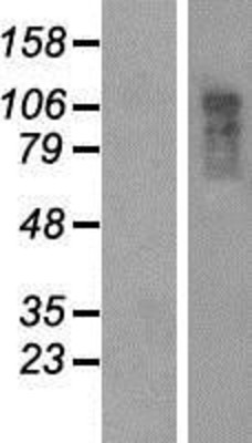 Western Blot: CCD80 Overexpression Lysate (Adult Normal) [NBP2-04618] Left-Empty vector transfected control cell lysate (HEK293 cell lysate); Right -Over-expression Lysate for CCD80.