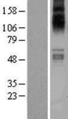 Western Blot: SLC1A7 Overexpression Lysate (Adult Normal) [NBP2-04316] Left-Empty vector transfected control cell lysate (HEK293 cell lysate); Right -Over-expression Lysate for SLC1A7.
