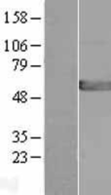 Western Blot: GPT2 Overexpression Lysate (Adult Normal) [NBL1-11313] Left-Empty vector transfected control cell lysate (HEK293 cell lysate); Right -Over-expression Lysate for GPT2.