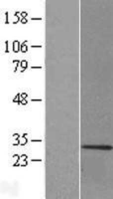 Western Blot: Myelin Basic Overexpression Lysate (Adult Normal) [NBL1-12934] Left-Empty vector transfected control cell lysate (HEK293 cell lysate); Right -Over-expression Lysate for Myelin Basic.