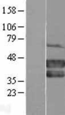 Western Blot: MEL-18 Overexpression Lysate (Adult Normal) [NBL1-14174] Left-Empty vector transfected control cell lysate (HEK293 cell lysate); Right -Over-expression Lysate for MEL-18.