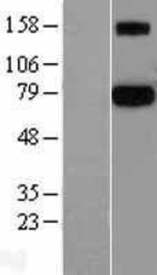 Western Blot: Protein S Overexpression Lysate (Adult Normal) [NBL1-14812] Left-Empty vector transfected control cell lysate (HEK293 cell lysate); Right -Over-expression Lysate for Protein S.