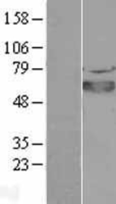 Western Blot: SOX4 Overexpression Lysate (Adult Normal) [NBL1-16352] Left-Empty vector transfected control cell lysate (HEK293 cell lysate); Right -Over-expression Lysate for SOX4.