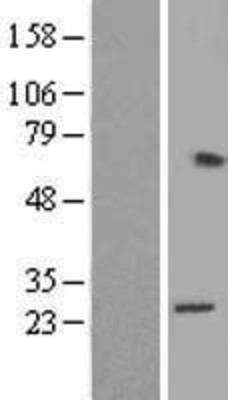 Western Blot: RPL15 Overexpression Lysate (Adult Normal) [NBL1-15508] Left-Empty vector transfected control cell lysate (HEK293 cell lysate); Right -Over-expression Lysate for RPL15.
