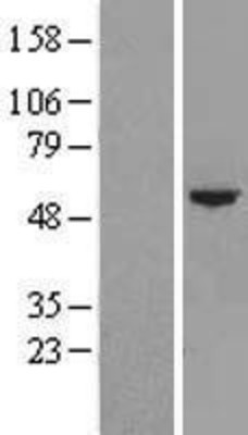 Western Blot: CYP4F22 Overexpression Lysate (Adult Normal) [NBL1-09699] Left-Empty vector transfected control cell lysate (HEK293 cell lysate); Right -Over-expression Lysate for CYP4F22.