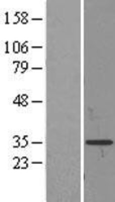 Western Blot: Dynorphin Overexpression Lysate (Adult Normal) [NBL1-14268] Left-Empty vector transfected control cell lysate (HEK293 cell lysate); Right -Over-expression Lysate for Dynorphin.