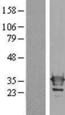 Western Blot: Galectin-3 Overexpression Lysate (Adult Normal) [NBL1-12501] Left-Empty vector transfected control cell lysate (HEK293 cell lysate); Right -Over-expression Lysate for Galectin-3.