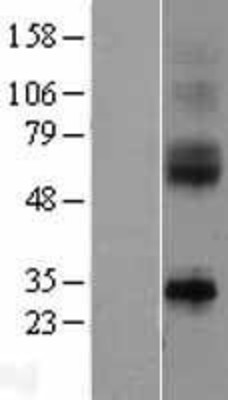 Western Blot: IL9R Overexpression Lysate (Adult Normal) [NBL1-11971] Left-Empty vector transfected control cell lysate (HEK293 cell lysate); Right -Over-expression Lysate for IL9R.