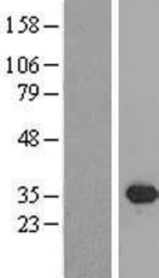 Western Blot: SIX2 Overexpression Lysate (Adult Normal) [NBL1-15983] Left-Empty vector transfected control cell lysate (HEK293 cell lysate); Right -Over-expression Lysate for SIX2.