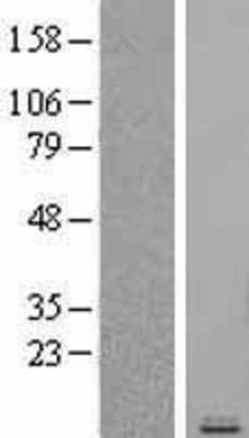 Western Blot: RANTES Overexpression Lysate (Adult Normal) [NBL1-08860] Left-Empty vector transfected control cell lysate (HEK293 cell lysate); Right -Over-expression Lysate for RANTES.