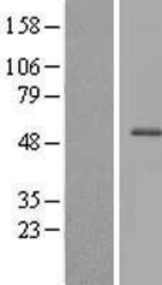 Western Blot: CXorf59 Overexpression Lysate (Adult Normal) [NBL1-09646] Left-Empty vector transfected control cell lysate (HEK293 cell lysate); Right -Over-expression Lysate for CXorf59.