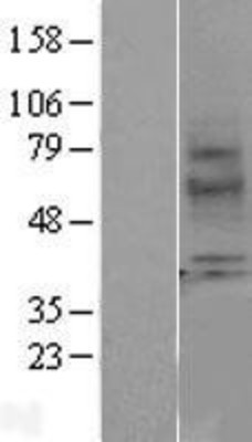 Western Blot: Melatonin Receptor 1A Overexpression Lysate (Adult Normal) [NBL1-13378] Left-Empty vector transfected control cell lysate (HEK293 cell lysate); Right -Over-expression Lysate for Melatonin Receptor 1A.