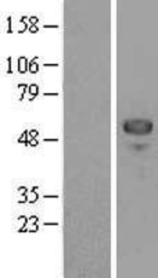 Western Blot: MEF2C Overexpression Lysate (Adult Normal) [NBL1-12999] Left-Empty vector transfected control cell lysate (HEK293 cell lysate); Right -Over-expression Lysate for MEF2C.