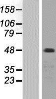 Western Blot: PKC zeta Overexpression Lysate (Adult Normal) [NBP2-11213] Left-Empty vector transfected control cell lysate (HEK293 cell lysate); Right -Over-expression Lysate for PKC zeta.