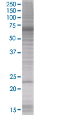 RAB38 transfected lysate